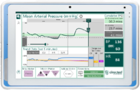 HDA display screen showing the trend (change over time) for blood pressure (green line) and cardiac output (CO, blue line).